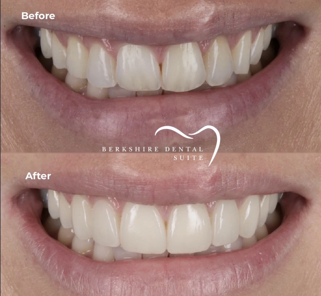 Complete original BDS smile-gallery before and after pair; treatment unspecified