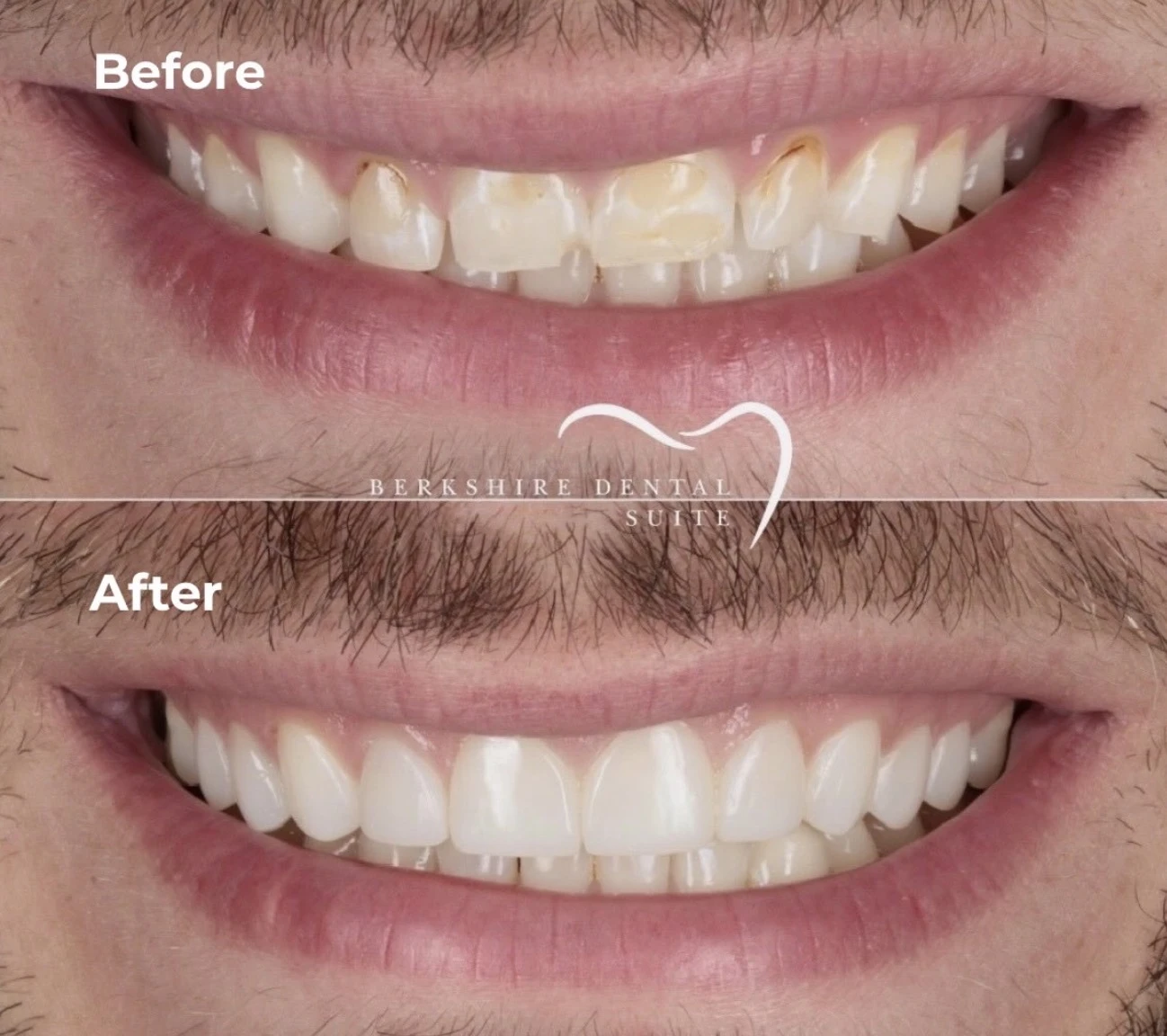Complete original BDS smile-gallery before and after pair; treatment unspecified